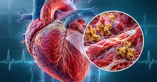 Scientific illustration of cardiac fibrosis and Galectin-3 activity